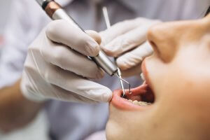 Massapequa, NY cavities treatment greater long island dental